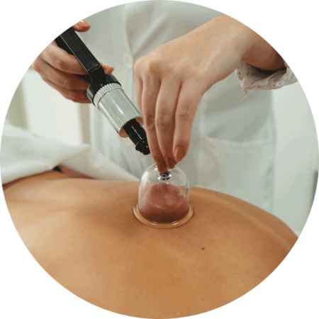 Dra. Mayte Peres - Biomedicina Estética: Ventosaterapia