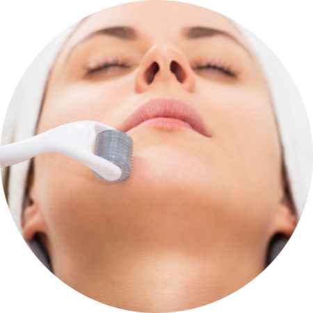 Dra. Mayte Peres - Biomedicina Estética: Microagulhamento